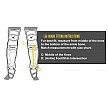 Easton Black Magic Legguards, Youth 12,5